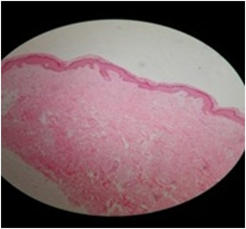 Figure 7: Histopathology of skin 